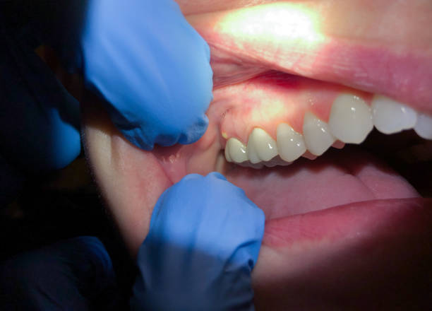 Best Emergency Root Canal Therapy in Timonium, MD